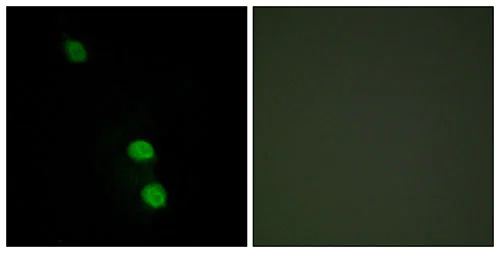 Immunocytochemistry/ Immunofluorescence - Anti-TEA domain family member 2/ETF antibody (AB196669)