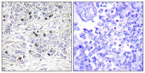 Immunohistochemistry (Formalin/PFA-fixed paraffin-embedded sections) - Anti-TEA domain family member 2/ETF antibody (AB196669)