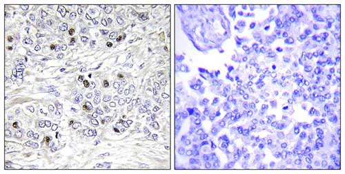 Immunohistochemistry (Formalin/PFA-fixed paraffin-embedded sections) - Anti-TEA domain family member 2/ETF antibody (AB196669)