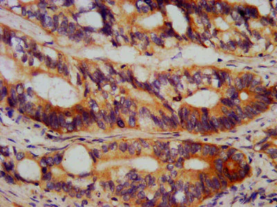 Immunohistochemistry (Formalin/PFA-fixed paraffin-embedded sections) - Anti-TEAD3 antibody (AB237766)