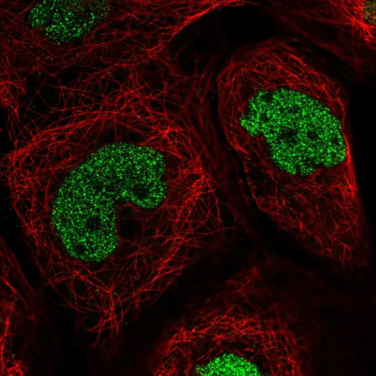 Immunocytochemistry/ Immunofluorescence - Anti-TEAD4 Antibody (AB327245)