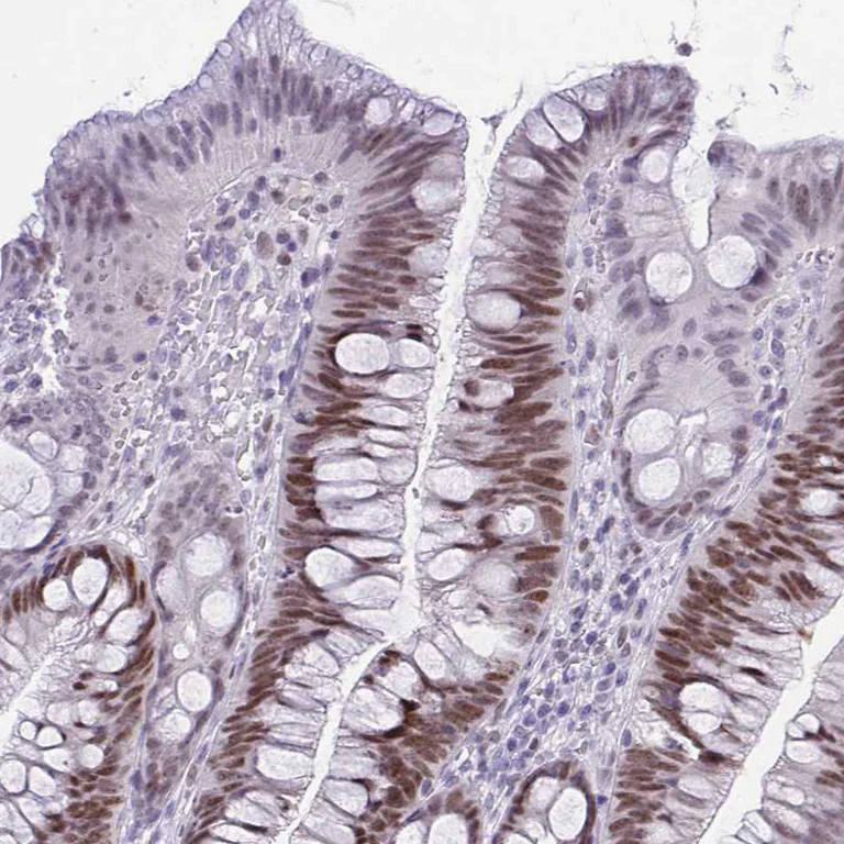 Immunohistochemistry (Formalin/PFA-fixed paraffin-embedded sections) - Anti-TEAD4 Antibody (AB327245)
