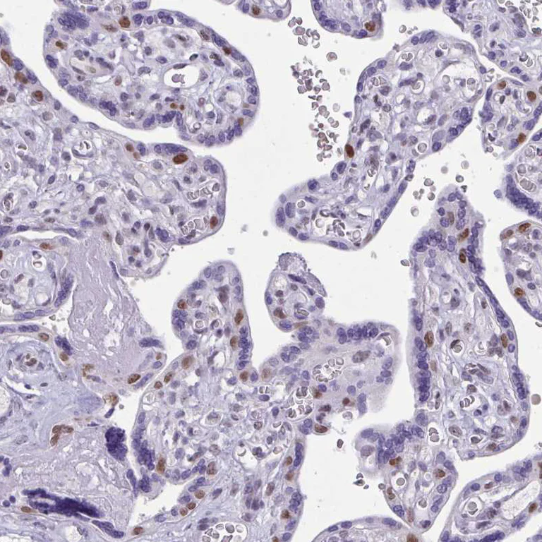 Immunohistochemistry (Formalin/PFA-fixed paraffin-embedded sections) - Anti-TEAD4 Antibody (AB327245)