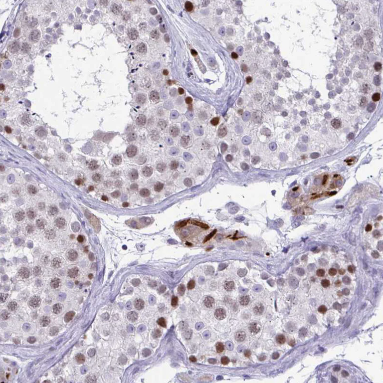 Immunohistochemistry (Formalin/PFA-fixed paraffin-embedded sections) - Anti-TEAD4 Antibody (AB327245)