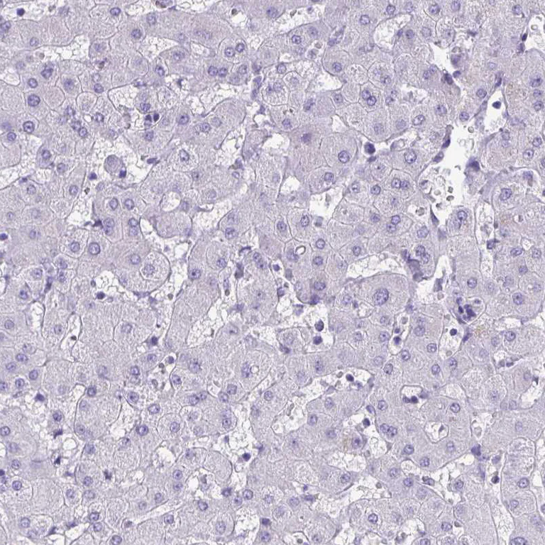 Immunohistochemistry (Formalin/PFA-fixed paraffin-embedded sections) - Anti-TEAD4 Antibody (AB327245)