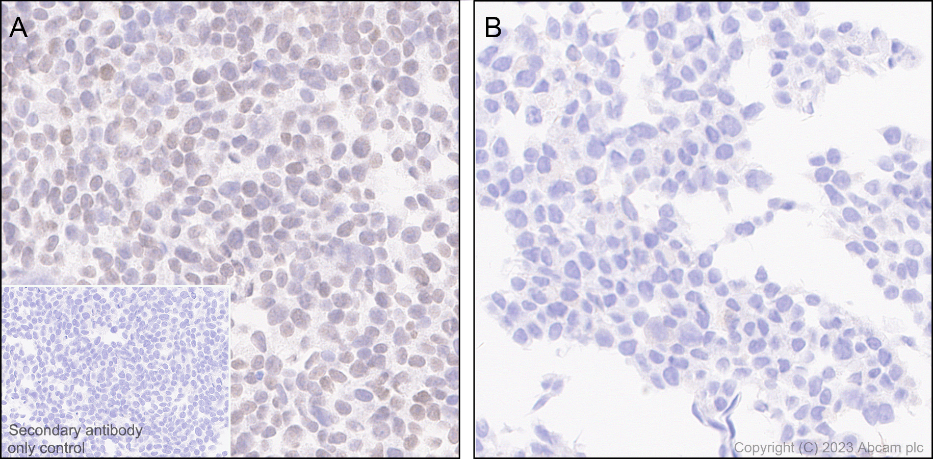 Immunohistochemistry (Formalin/PFA-fixed paraffin-embedded sections) - Anti-TEAD4/TEF-3 antibody [EPR26046-193] (AB308621)