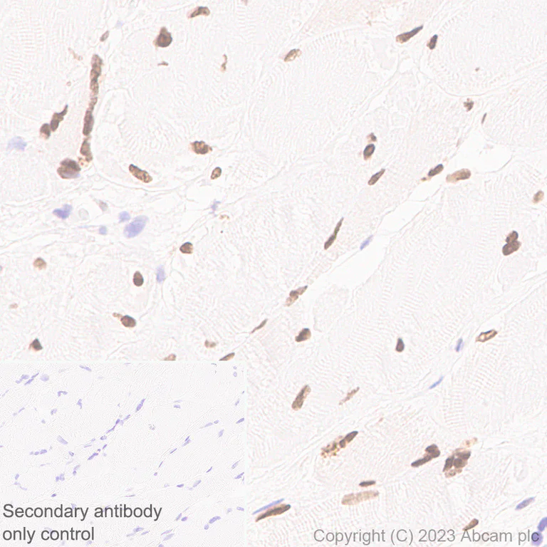 Immunohistochemistry (Formalin/PFA-fixed paraffin-embedded sections) - Anti-TEAD4/TEF-3 antibody [EPR26046-193] (AB308621)