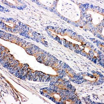 Immunohistochemistry (Formalin/PFA-fixed paraffin-embedded sections) - Anti-Tec antibody - C-terminal (AB191013)