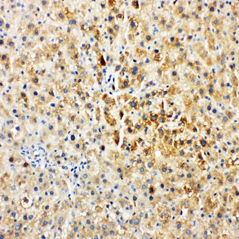 Immunohistochemistry (Formalin/PFA-fixed paraffin-embedded sections) - Anti-Tec antibody - C-terminal (AB191013)