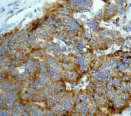 Immunohistochemistry (Formalin/PFA-fixed paraffin-embedded sections) - Anti-Tec antibody [Y398] (AB32368)