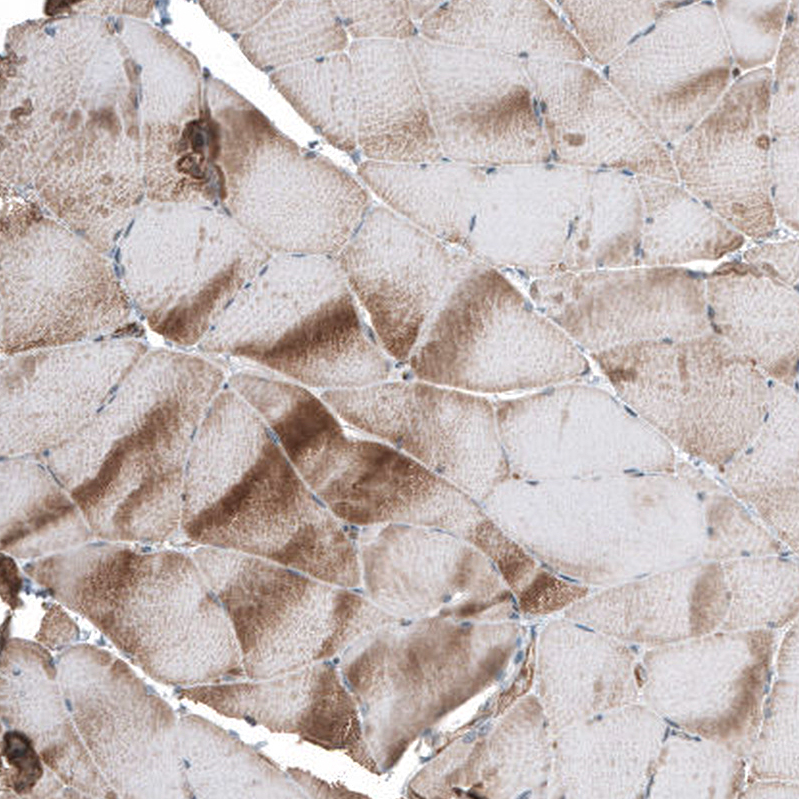 Immunohistochemistry (Formalin/PFA-fixed paraffin-embedded sections) - Anti-Telethonin antibody (AB121868)