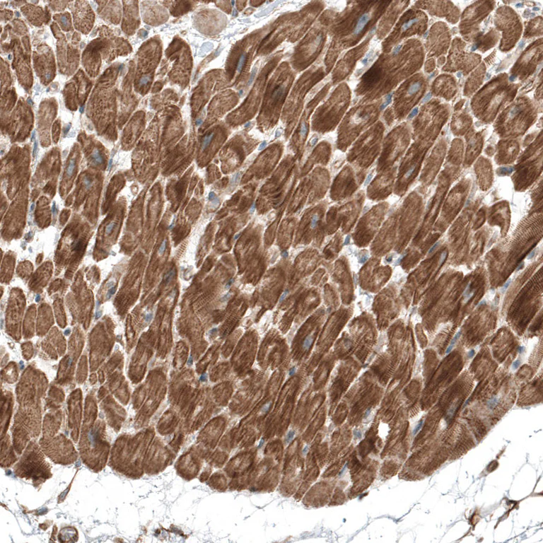 Immunohistochemistry (Formalin/PFA-fixed paraffin-embedded sections) - Anti-Telethonin antibody (AB121868)
