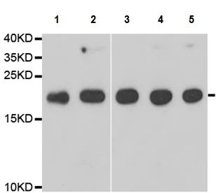Western blot - Anti-Telethonin antibody (AB210773)