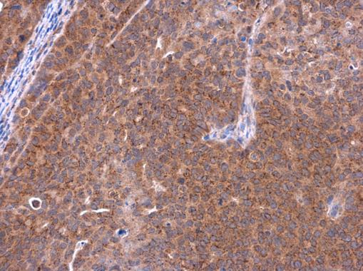Immunohistochemistry (Formalin/PFA-fixed paraffin-embedded sections) - Anti-Telethonin antibody (AB228582)