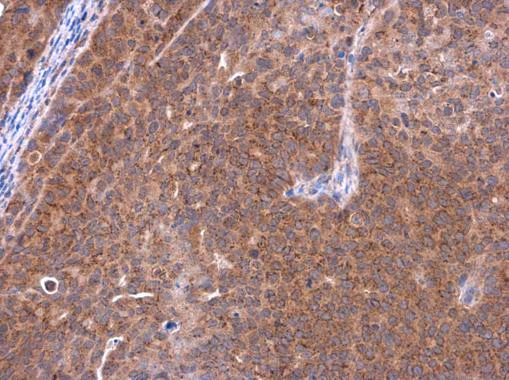Immunohistochemistry (Formalin/PFA-fixed paraffin-embedded sections) - Anti-Telethonin antibody (AB228582)