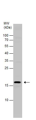 Western blot - Anti-Telethonin antibody (AB228582)