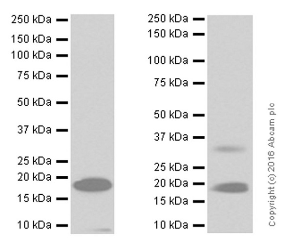 Anti-Telethonin antibody [EPR8375]