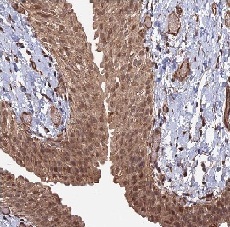 Immunohistochemistry (Formalin/PFA-fixed paraffin-embedded sections) - Anti-TELO2 antibody (AB122722), expandable thumbnail