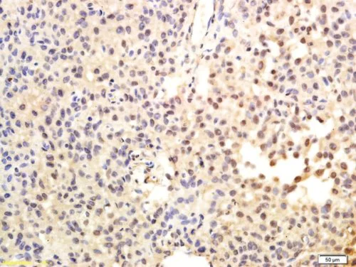 Immunohistochemistry (Formalin/PFA-fixed paraffin-embedded sections) - Anti-Telomerase reverse transcriptase antibody (AB216625)