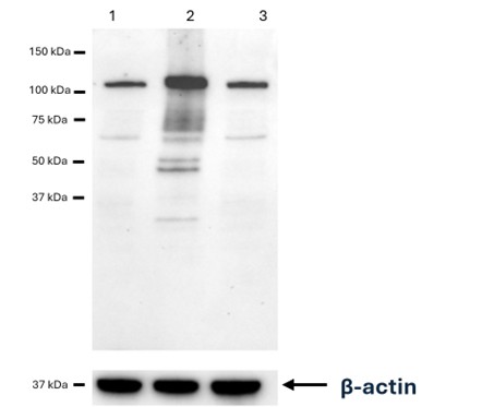 Western blot - Anti-Telomerase reverse transcriptase antibody [Y182] (Overexpressed) (AB32020)