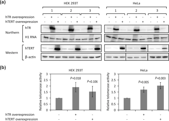 Western blot - Anti-Telomerase reverse transcriptase antibody [Y182] (Overexpressed)- BSA and Azide free (AB181830)