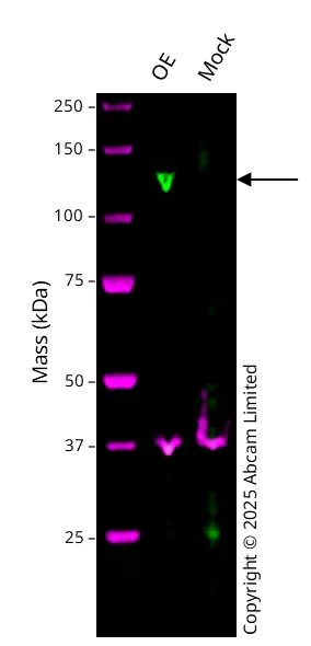 Western blot - Anti-Telomerase reverse transcriptase antibody [Y182] (Overexpressed)- BSA and Azide free (AB181830)