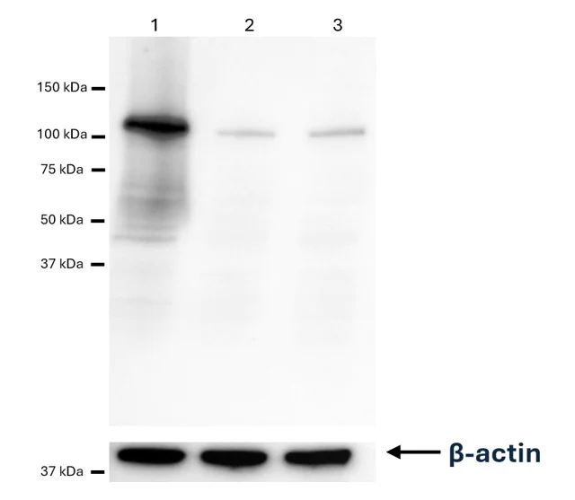 Western blot - Anti-Telomerase reverse transcriptase antibody [Y182] (Overexpressed)- BSA and Azide free (AB181830)