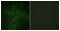 Immunocytochemistry/ Immunofluorescence - Anti-Telomerase reverse transcriptase (phospho S227) antibody (AB111584)