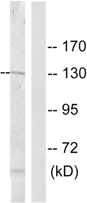 Western blot - Anti-Telomerase reverse transcriptase (phospho S824) antibody (AB63558)