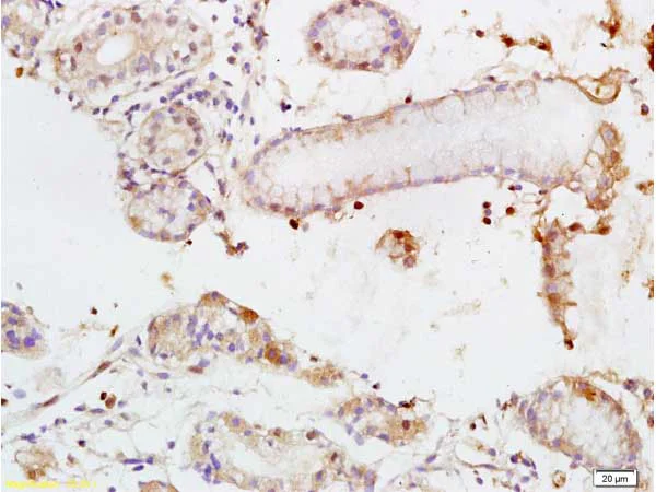 Immunohistochemistry (Formalin/PFA-fixed paraffin-embedded sections) - Anti-TEM1 antibody (AB217535)
