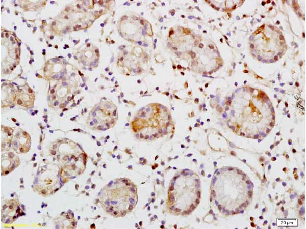 Immunohistochemistry (Formalin/PFA-fixed paraffin-embedded sections) - Anti-TEM1 antibody (AB217535)