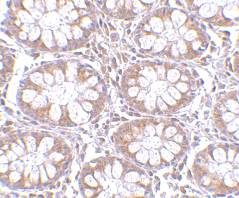 Immunohistochemistry (Formalin/PFA-fixed paraffin-embedded sections) - Anti-TEM1 antibody (AB67273)
