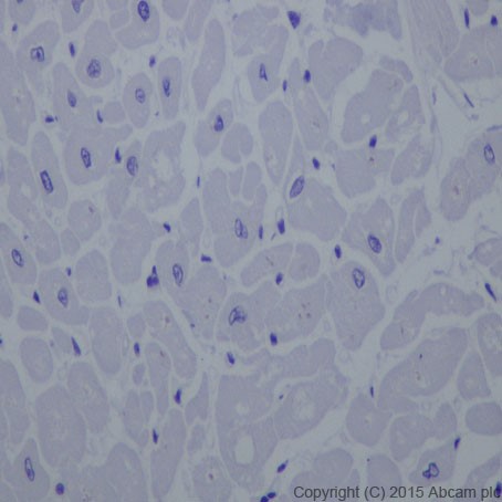 Immunohistochemistry (Formalin/PFA-fixed paraffin-embedded sections) - Anti-TEM1 antibody [EPR17081] (AB204914)