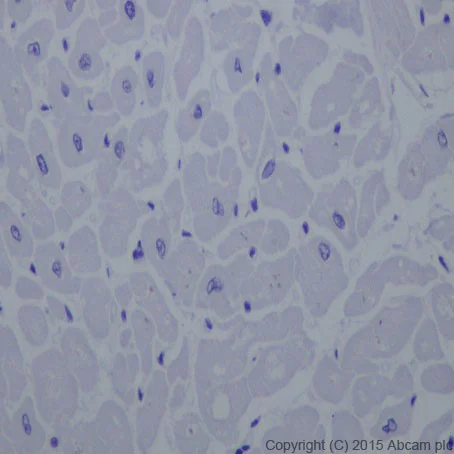 Immunohistochemistry (Formalin/PFA-fixed paraffin-embedded sections) - Anti-TEM1 antibody [EPR17081] - BSA and Azide free (AB251416)
