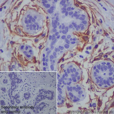 Immunohistochemistry (Formalin/PFA-fixed paraffin-embedded sections) - Anti-TEM1 antibody [EPR17081] - BSA and Azide free (AB251416)
