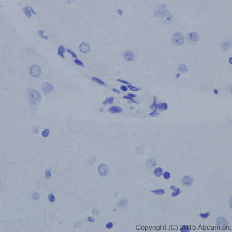 Immunohistochemistry (Formalin/PFA-fixed paraffin-embedded sections) - Anti-TEM1 antibody [EPR17081] - BSA and Azide free (AB251416)