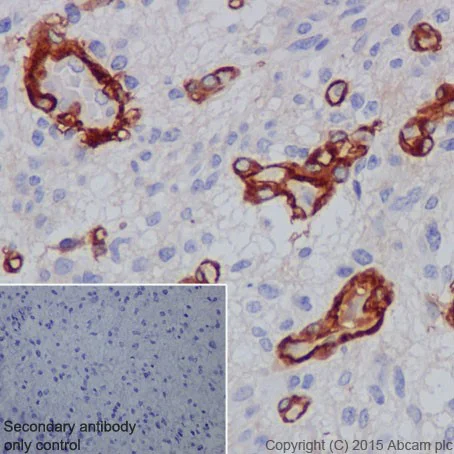 Immunohistochemistry (Formalin/PFA-fixed paraffin-embedded sections) - Anti-TEM1 antibody [EPR17081] - BSA and Azide free (AB251416)