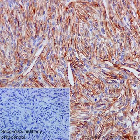 Immunohistochemistry (Formalin/PFA-fixed paraffin-embedded sections) - Anti-TEM1 antibody [EPR17081] - BSA and Azide free (AB251416)