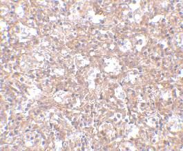 Immunohistochemistry (Formalin/PFA-fixed paraffin-embedded sections) - Anti-TEM4 antibody (AB67278)