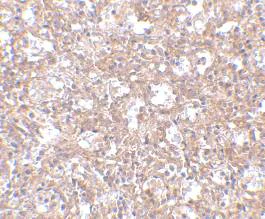 Immunohistochemistry (Formalin/PFA-fixed paraffin-embedded sections) - Anti-TEM4 antibody (AB67278)