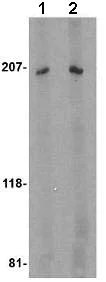 Western blot - Anti-TEM4 antibody (AB67278)