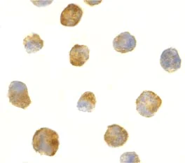 Immunocytochemistry/ Immunofluorescence - Anti-TEM8/ATR antibody (AB21269)