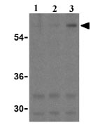 Western blot - Anti-TEM8/ATR antibody (AB21269), expandable thumbnail