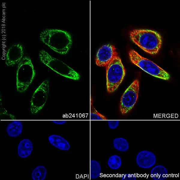 Immunocytochemistry/ Immunofluorescence - Anti-TEM8/ATR antibody [EPNCI-R173-37] (AB241067)