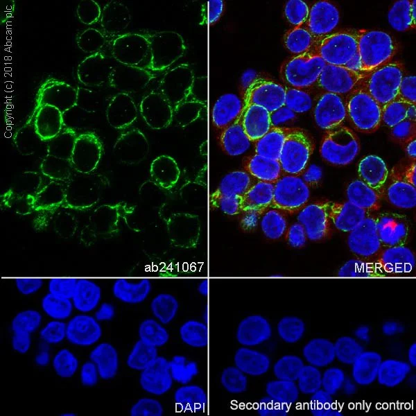 Immunocytochemistry/ Immunofluorescence - Anti-TEM8/ATR antibody [EPNCI-R173-37] (AB241067)
