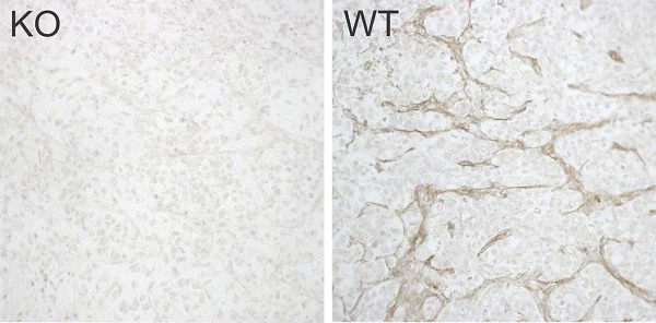 Immunohistochemistry (Formalin/PFA-fixed paraffin-embedded sections) - Anti-TEM8/ATR antibody [EPNCI-R173-37] (AB241067)