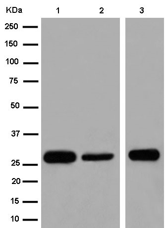 Western blot - Anti-TEMT antibody [EPR13240-105] (AB184573)