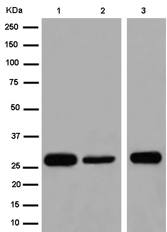 Western blot - Anti-TEMT antibody [EPR13240-105] - BSA and Azide free (AB250773)
