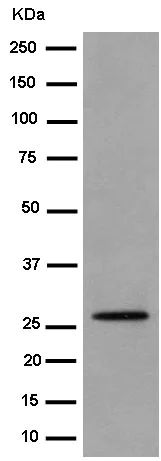 Western blot - Anti-TEMT antibody [EPR13240-105] - BSA and Azide free (AB250773)