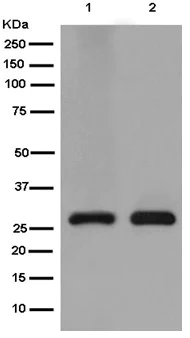 Western blot - Anti-TEMT antibody [EPR13240] - BSA and Azide free (AB250525)